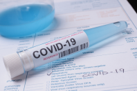 UTILIZZO DEI TEST ANTIGENICI RAPIDI EXTRA SSR
